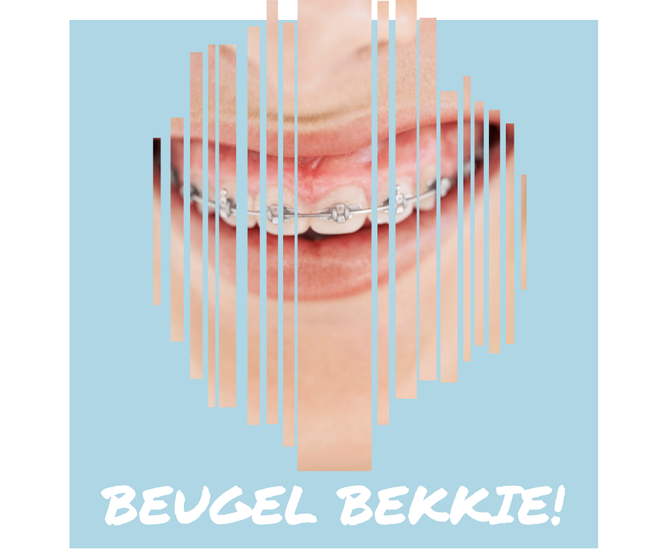 beugel bekkie